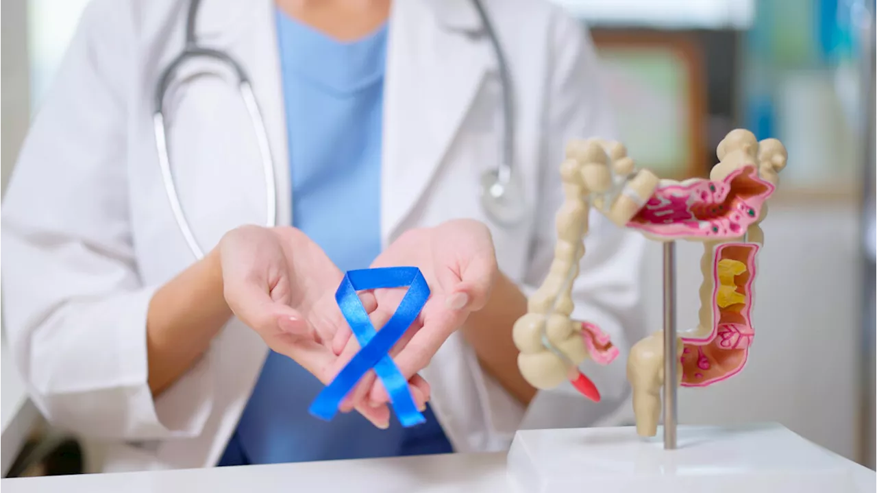 Una nuova strategia rende i tumori del colon-retto sensibili all'immunoterapia