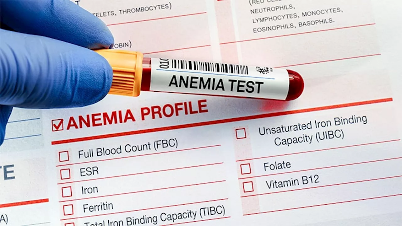 Photo App Could Spot Anemia in Seconds