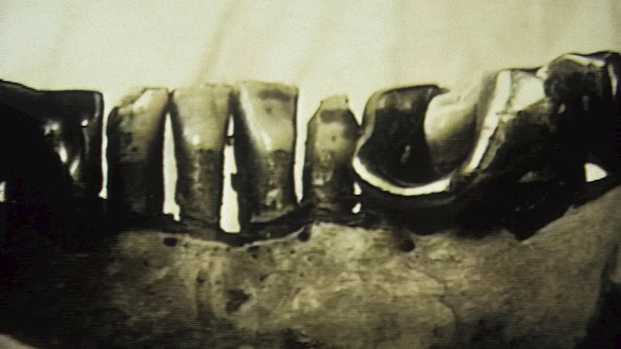 Behind History’s Icons II: Hitler’s Jaw and Cold War Secrets