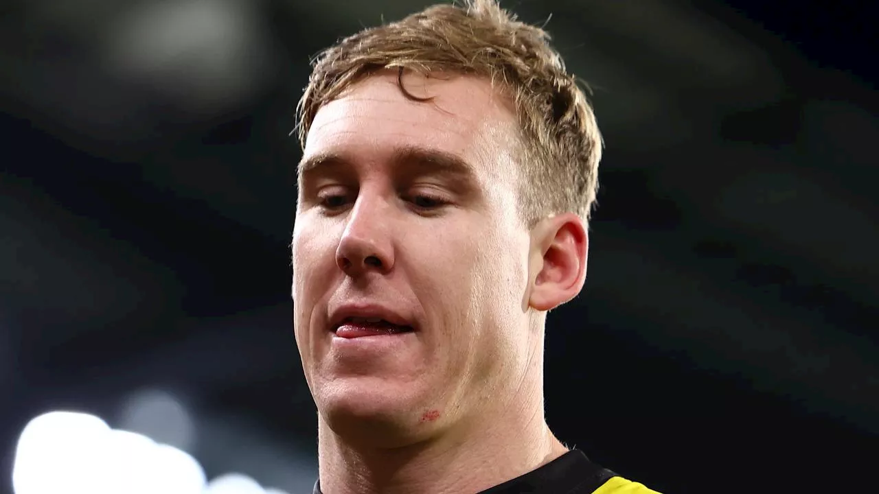 ‘Probably needs to get out’: Shock exit call in fears ‘embarrassment’ behind brutal punch