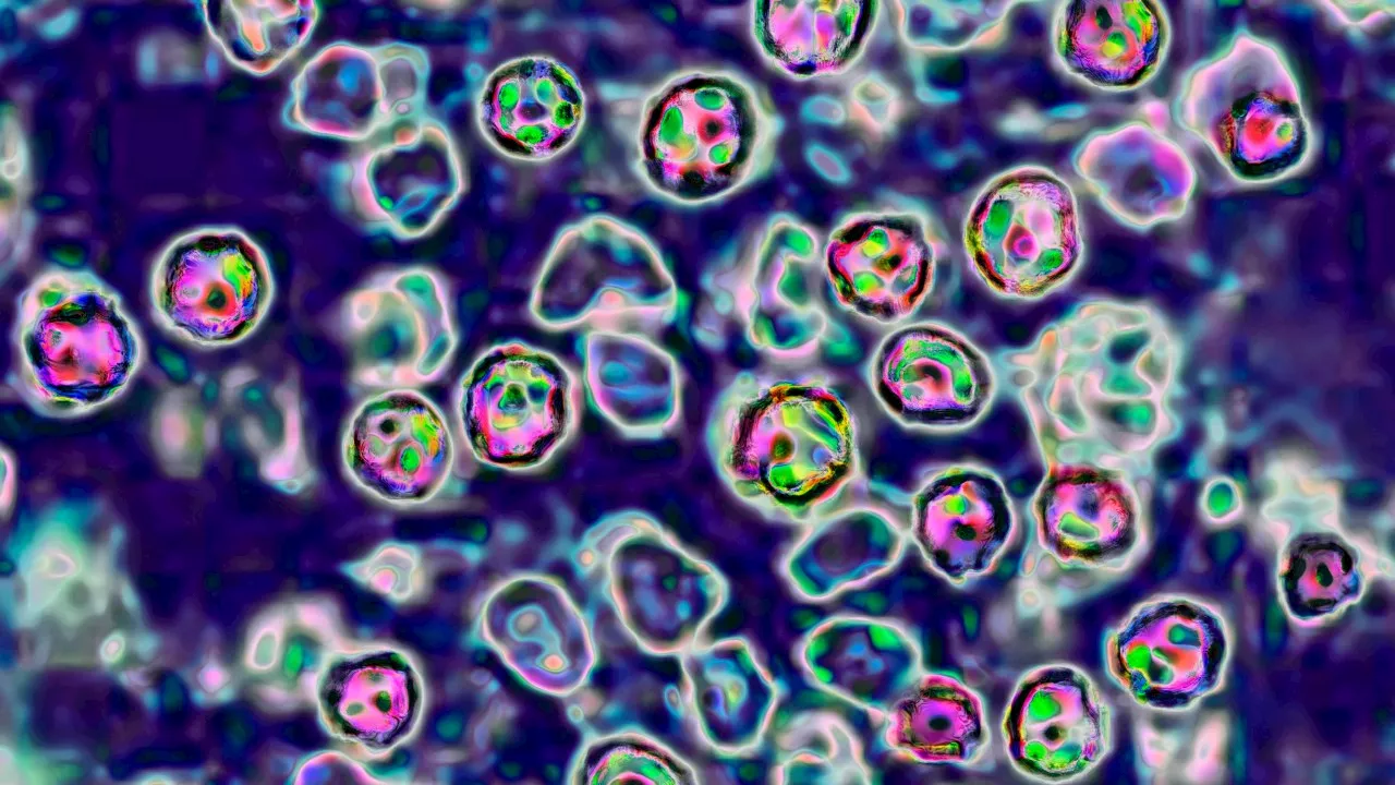 NSW Health issues measles alert following outbreak in Sydney