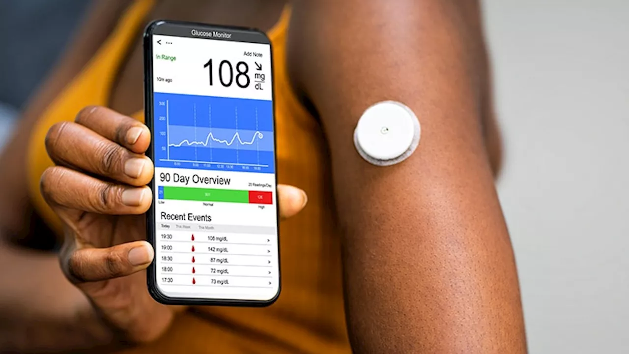 Should You Consider CGMs for Patients With Early Diabetes?