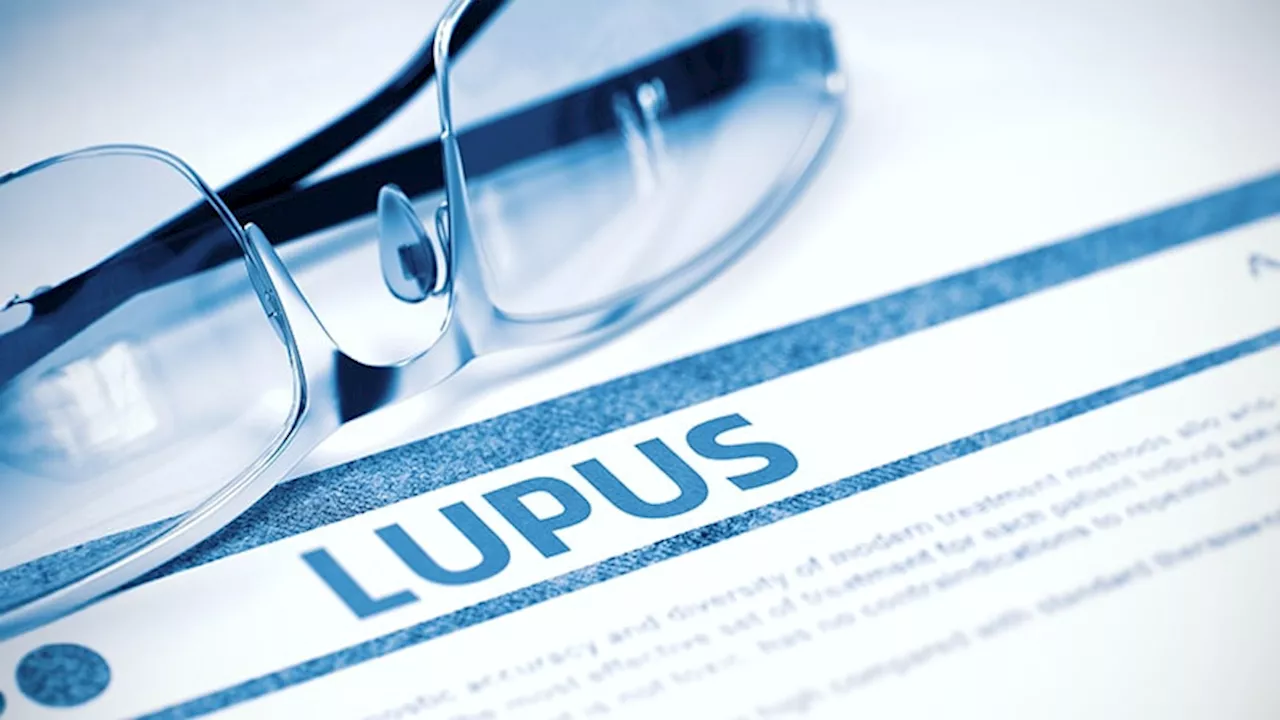 ACR Releases New Guideline for Lupus Treatment in Adults and Children