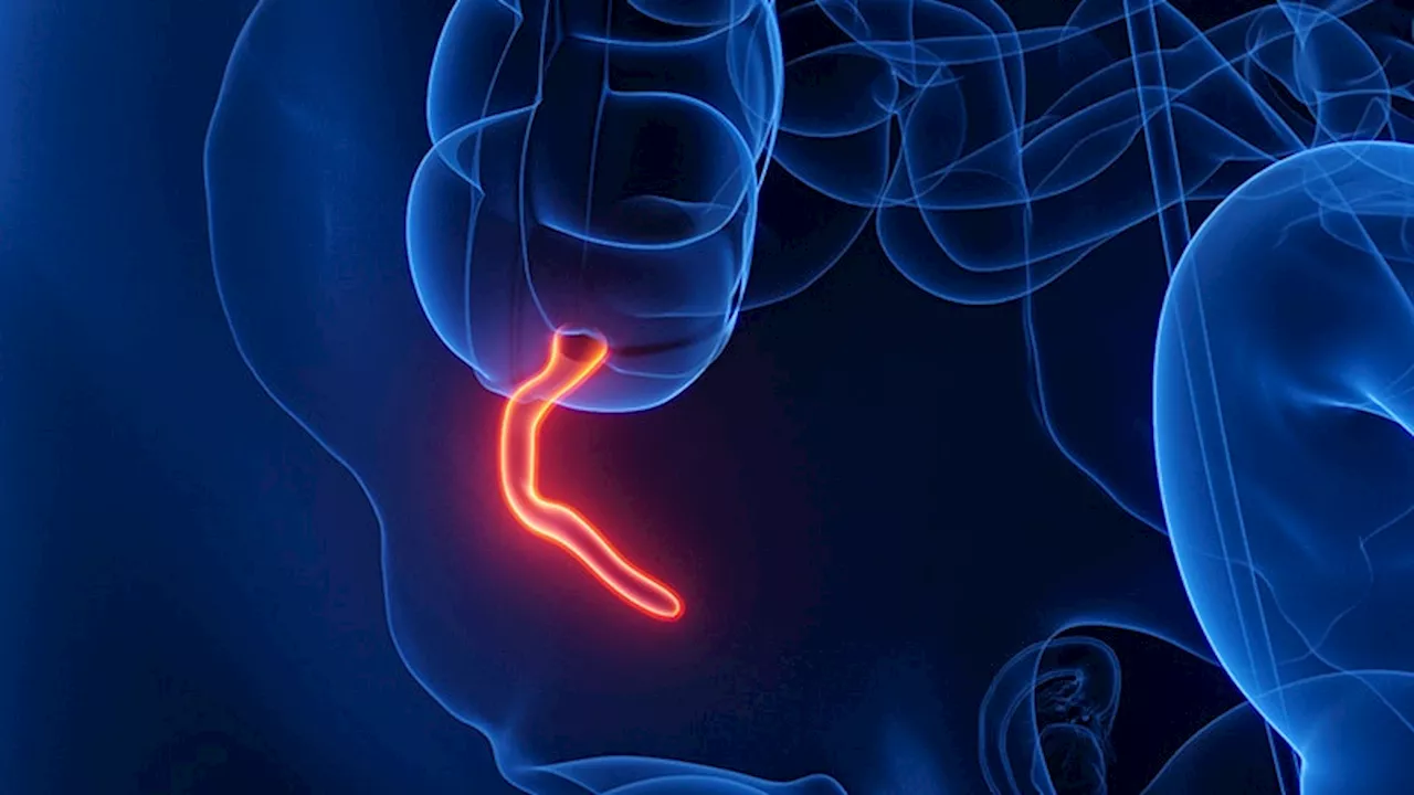 Gen X, Millennials Face Higher Risk for Rare Appendix Cancer