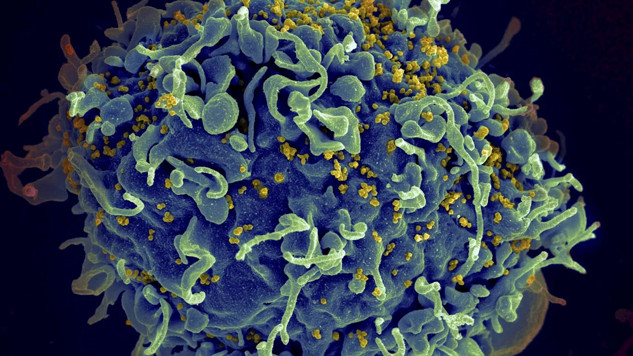 UN says if US funding for HIV programs is not replaced, millions more will die by 2029