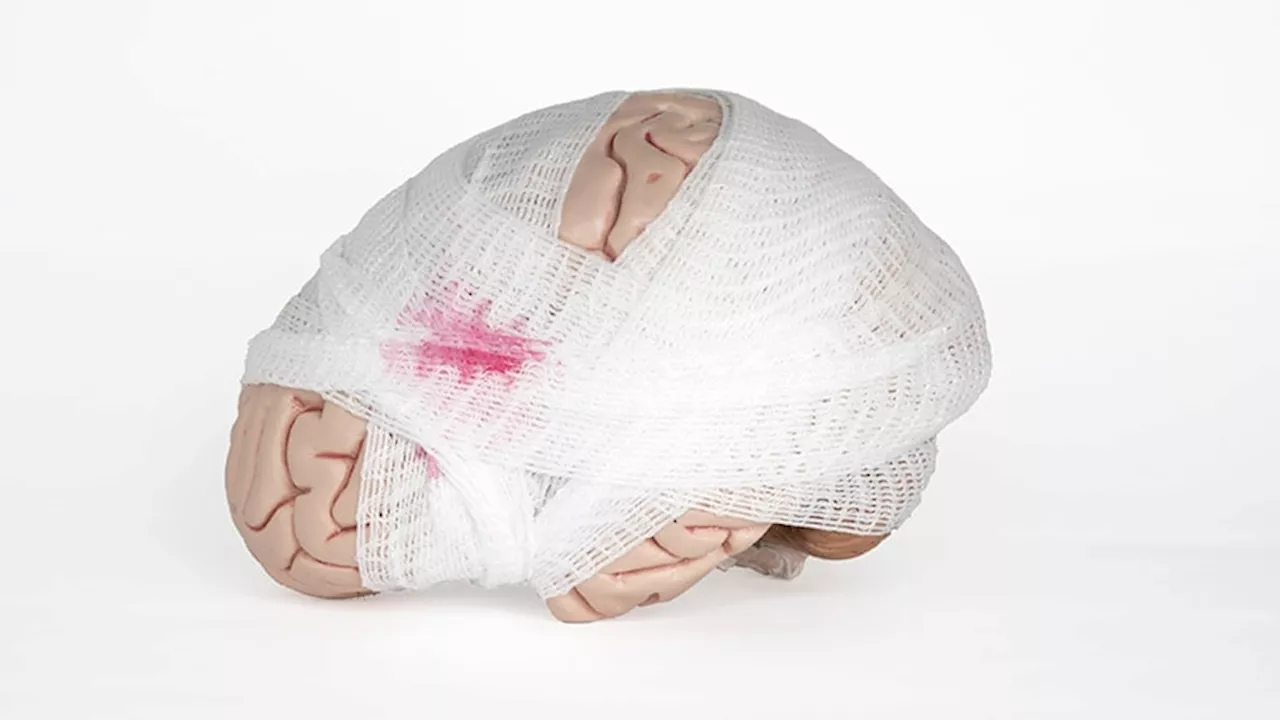 Risk Factors ID’d for Persistent Concussion Symptoms in Mild TBI