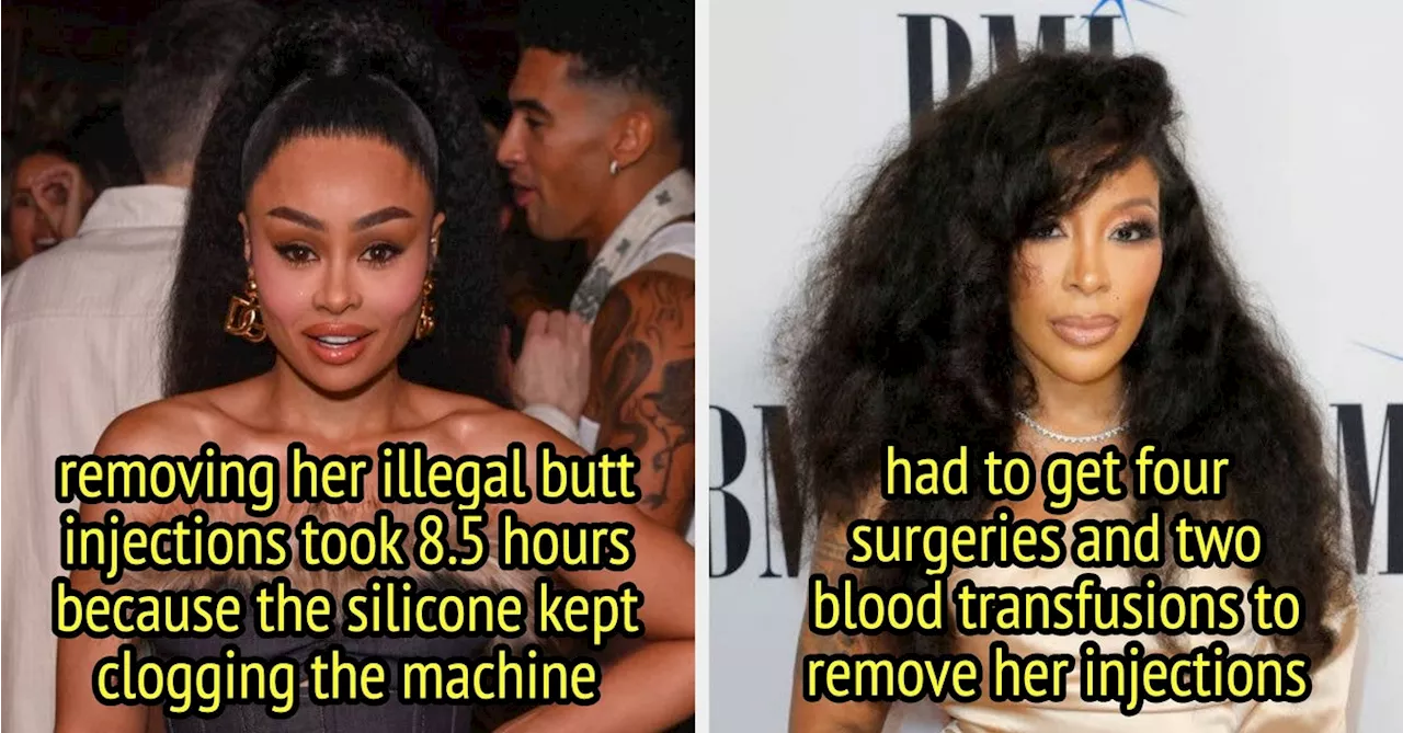 K. Michelle's Horrific Experience with Illegal Butt Injections: A Warning to Others