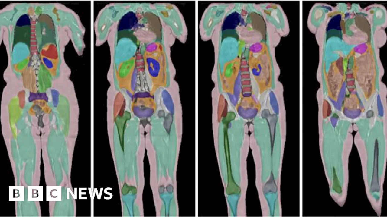 Biggest human imaging study scans 100,000th UK volunteer