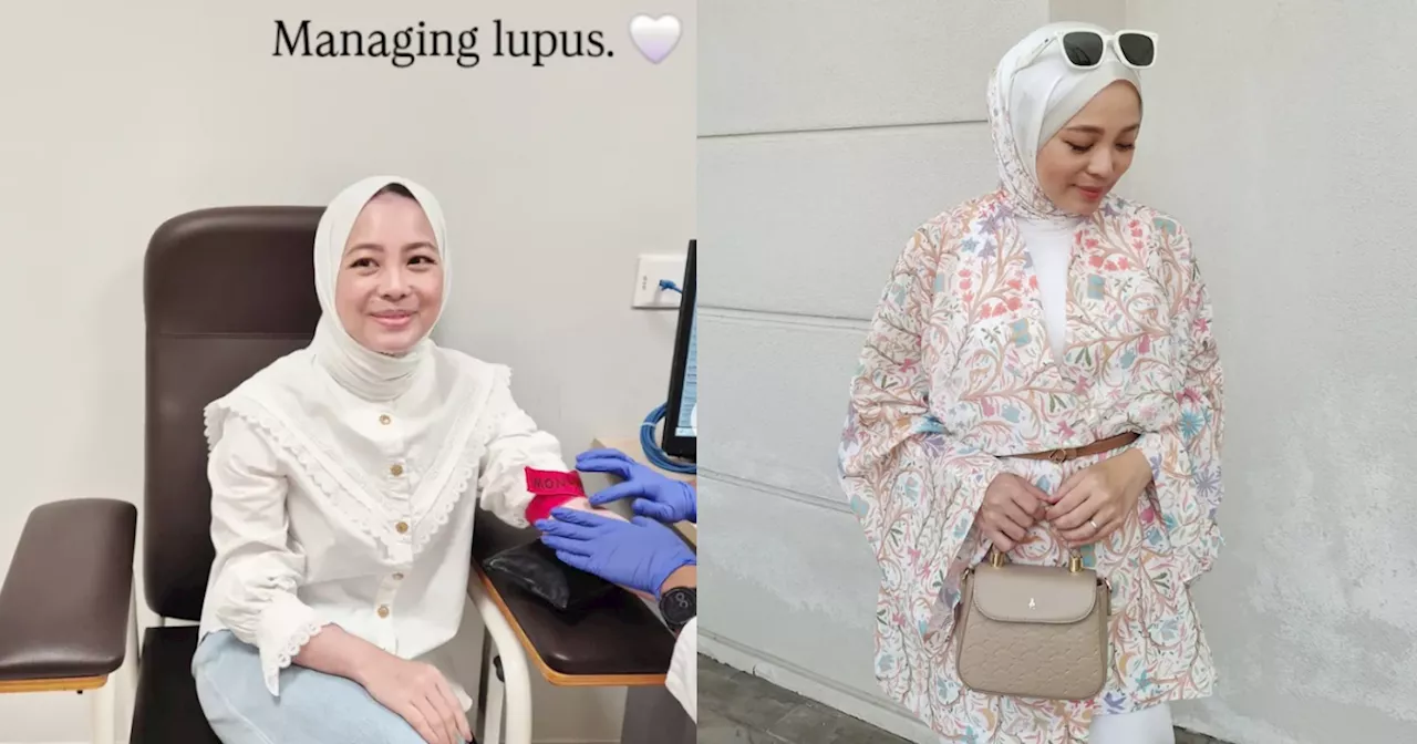 Vivy Yusof Berjuang Dengan Penyakit Lupus, Kongsi Stres Buat Keadaan Lebih Teruk
