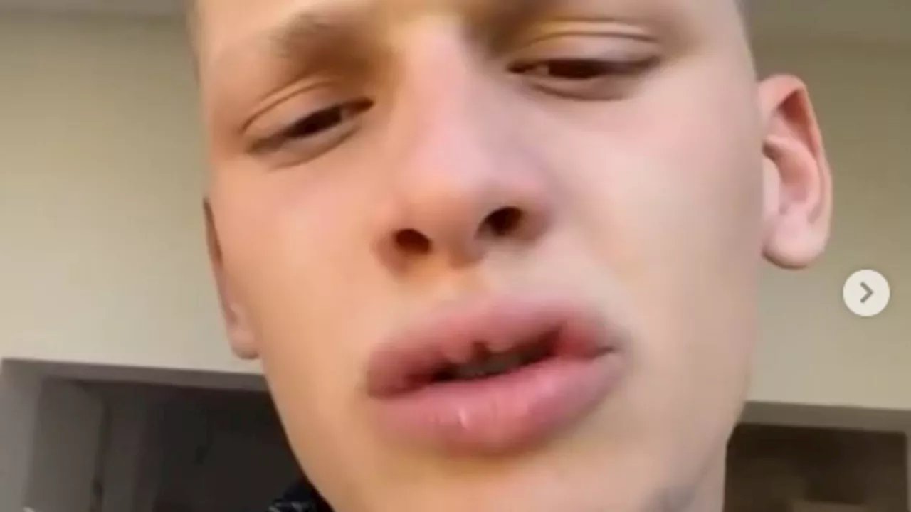 Freddy Brazier, 20, reveals he missed flight to Ibiza after getting PUNCHED and handed a fine on his way to the airport for impromptu trip