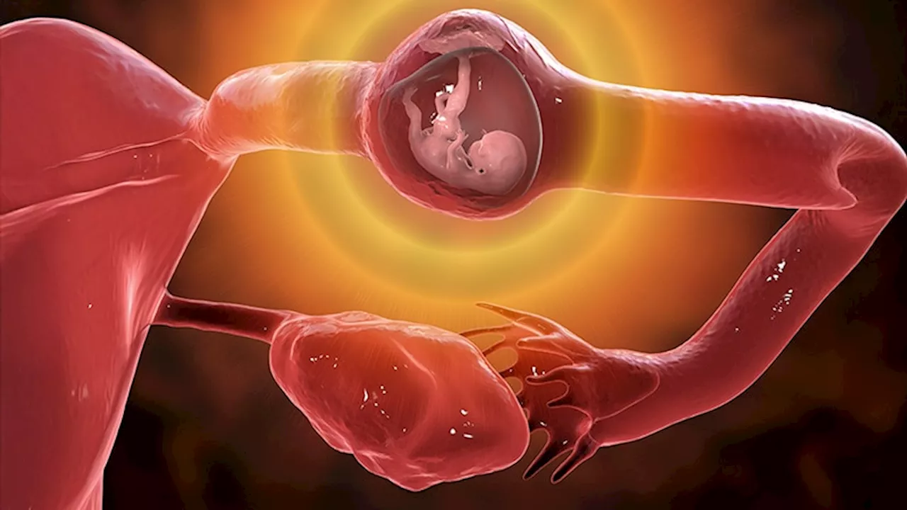 Single-Dose Methotrexate Less Effective in Recurrent Ectopic Pregnancy Treatment