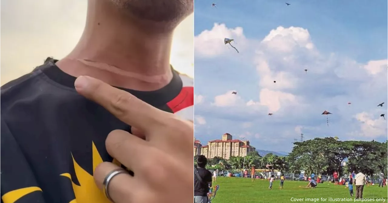 DBKL Responds After Motorcyclist’s Neck Is Slashed By Kite String Near Kepong Park