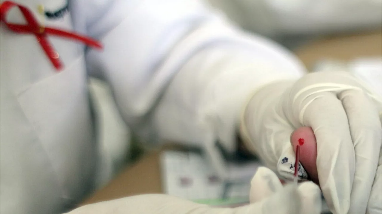 Hiv, primo via libera in Ue a farmaco che protegge dal contagio per 6 mesi
