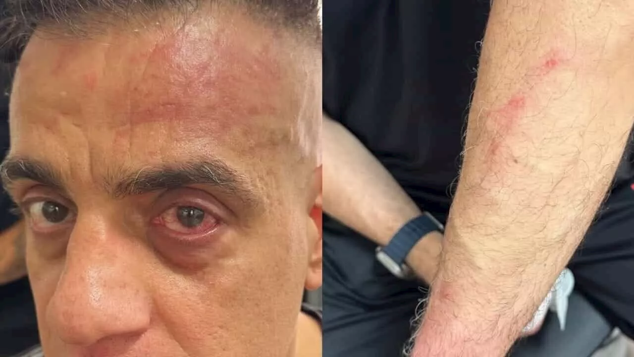 Aggressione a Cicalone a Napoli: YouTuber colpito all'esterno della stazione centrale