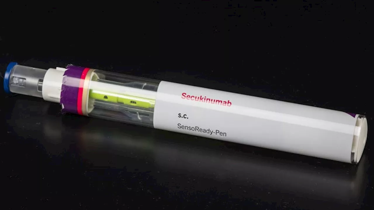 Secukinumab in Early PsA Starts Fast vs Standard of Care in Treat-to-Target Strategy