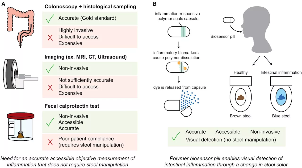 New swallowable sensor pill reveals gut inflammation with a simple color change