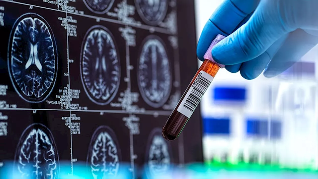 New Trials, New Targets: New Hope for Alzheimer’s