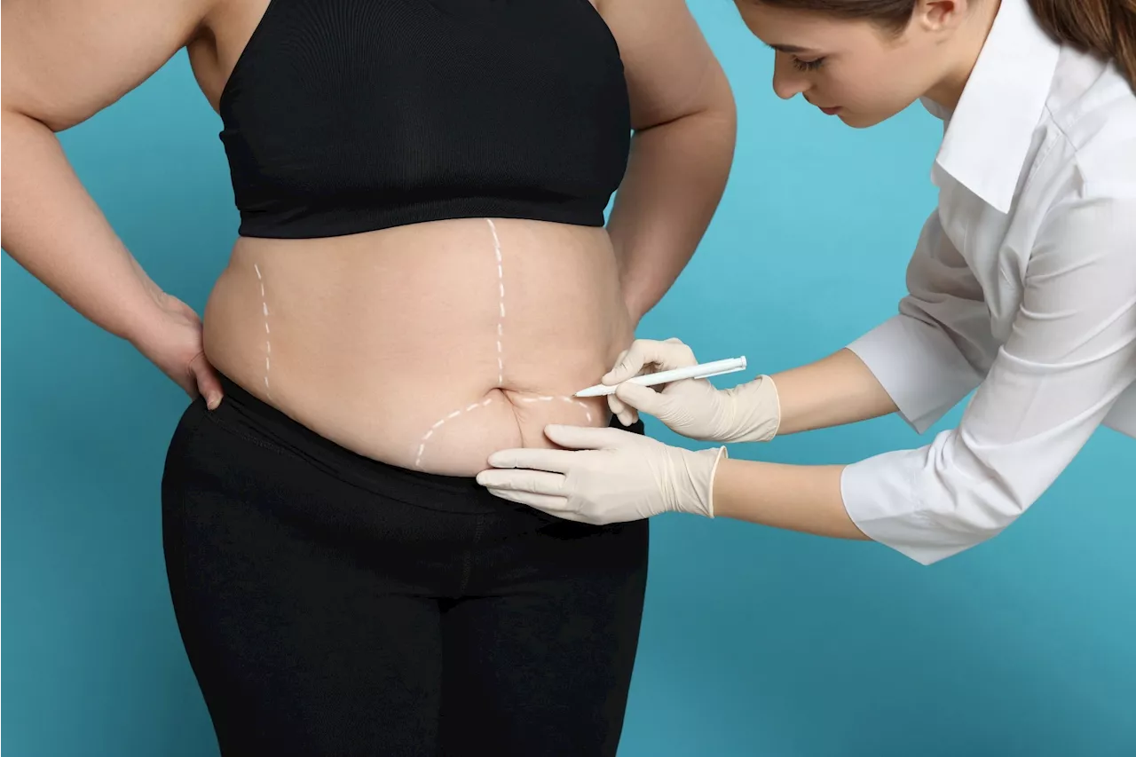 Patients face vitamin deficiencies years after bariatric surgery