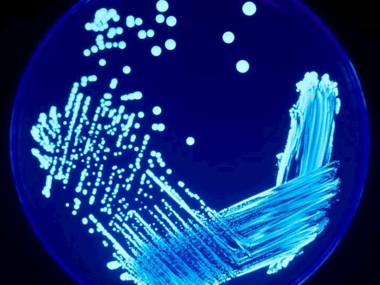 Allarme Legionella, a Milano un morto e casi in aumento: l'origine del focolaio