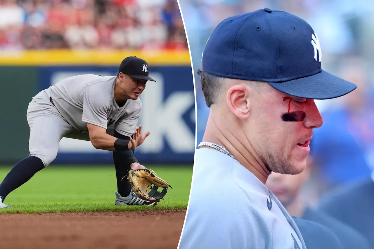 Aaron Judge bloodied after getting hit by Anthony Volpe throw between innings in wild Yankees moment
