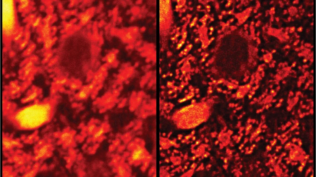 Cellule in super-HD grazie a un bisturi di luce