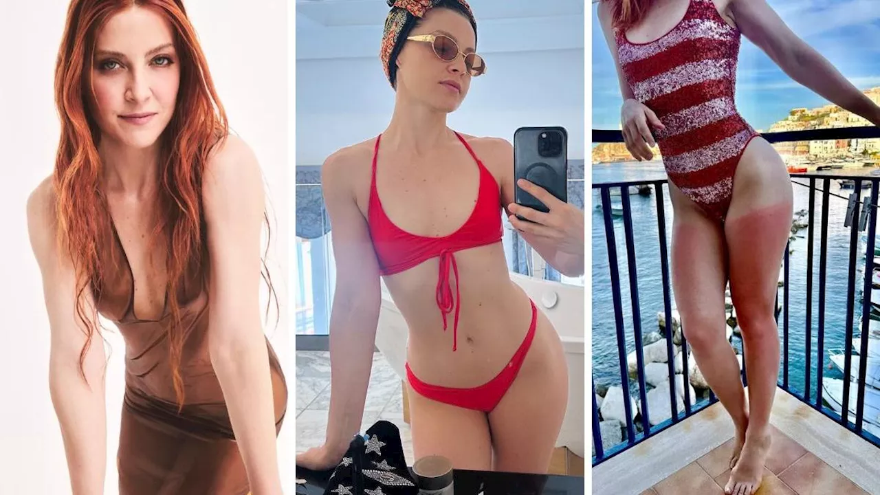 Noemi, che scottatura! Le gambe sono rosse come un peperone...