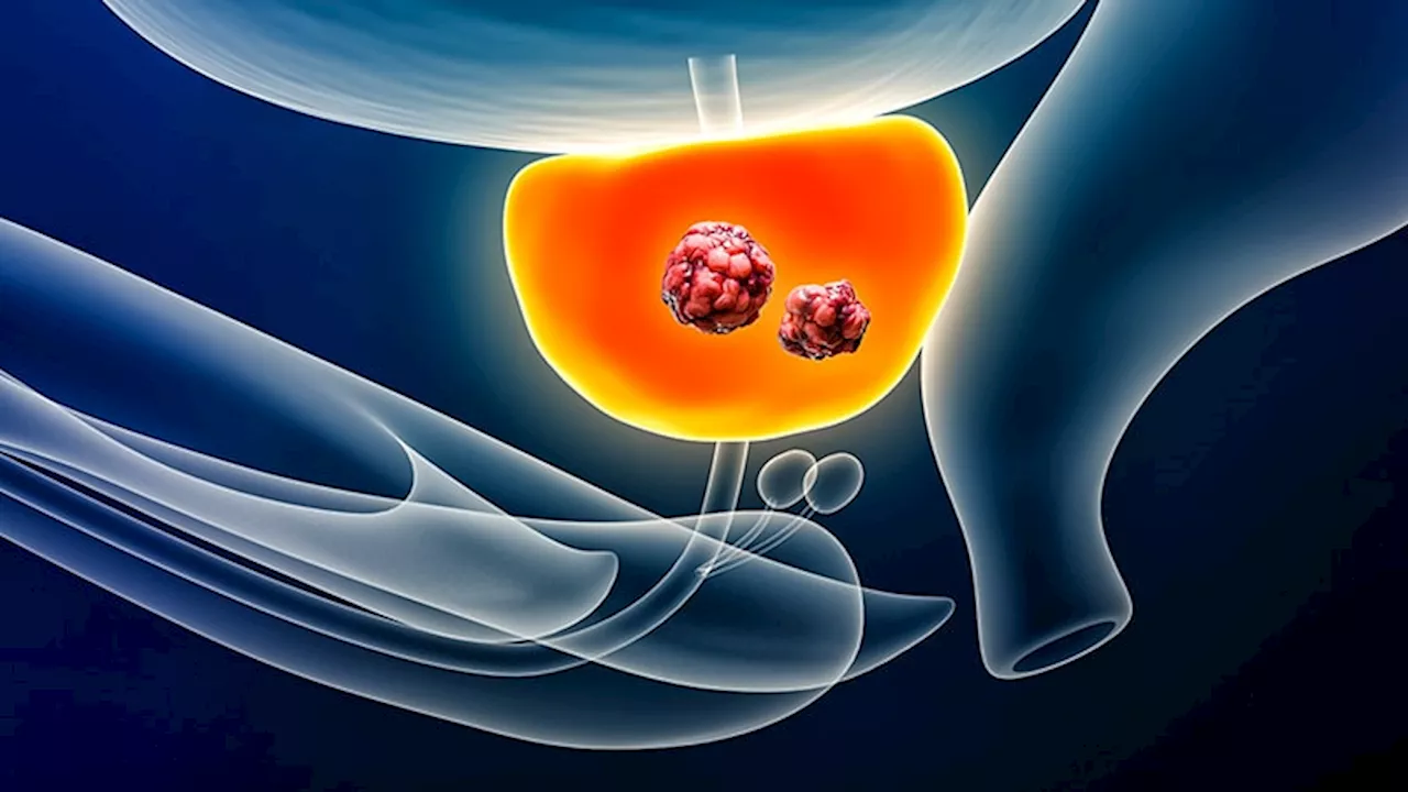 Erectile Function After Prostate Radiation: How MRI May Help