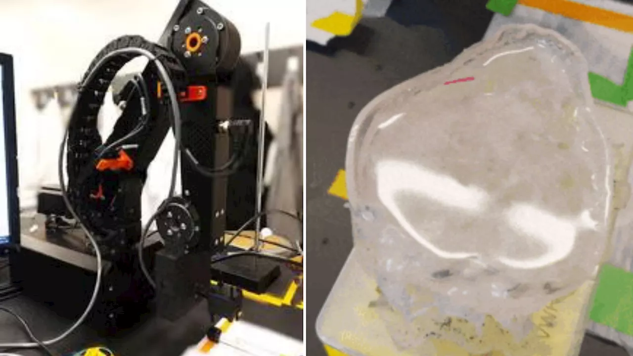 Tiny magnetic ‘robot’ could help dissolve kidney stones faster with less pain