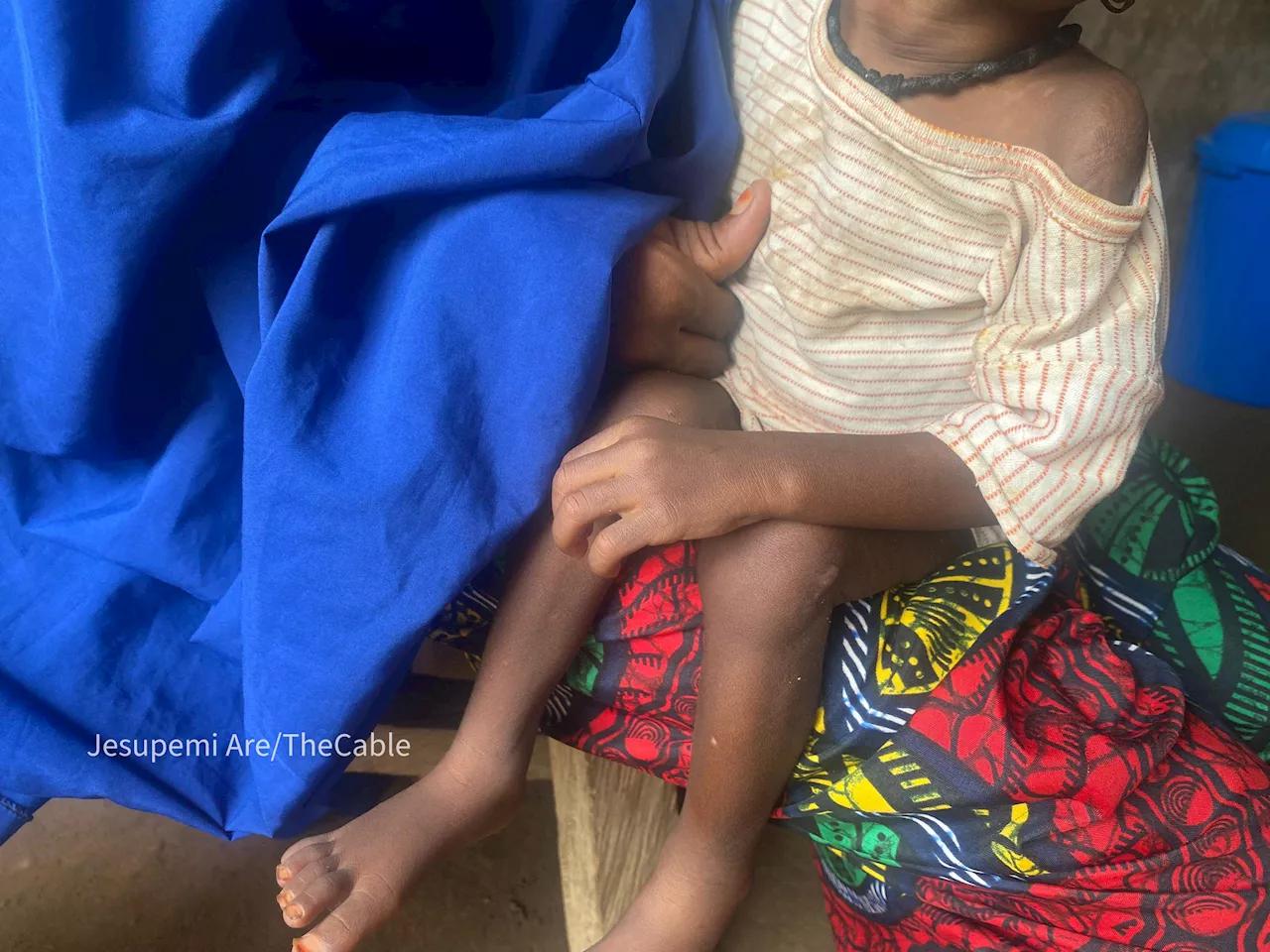 ‘Soaring prices, shrinking diets’ — how Nigeria’s economy is fuelling malnutrition