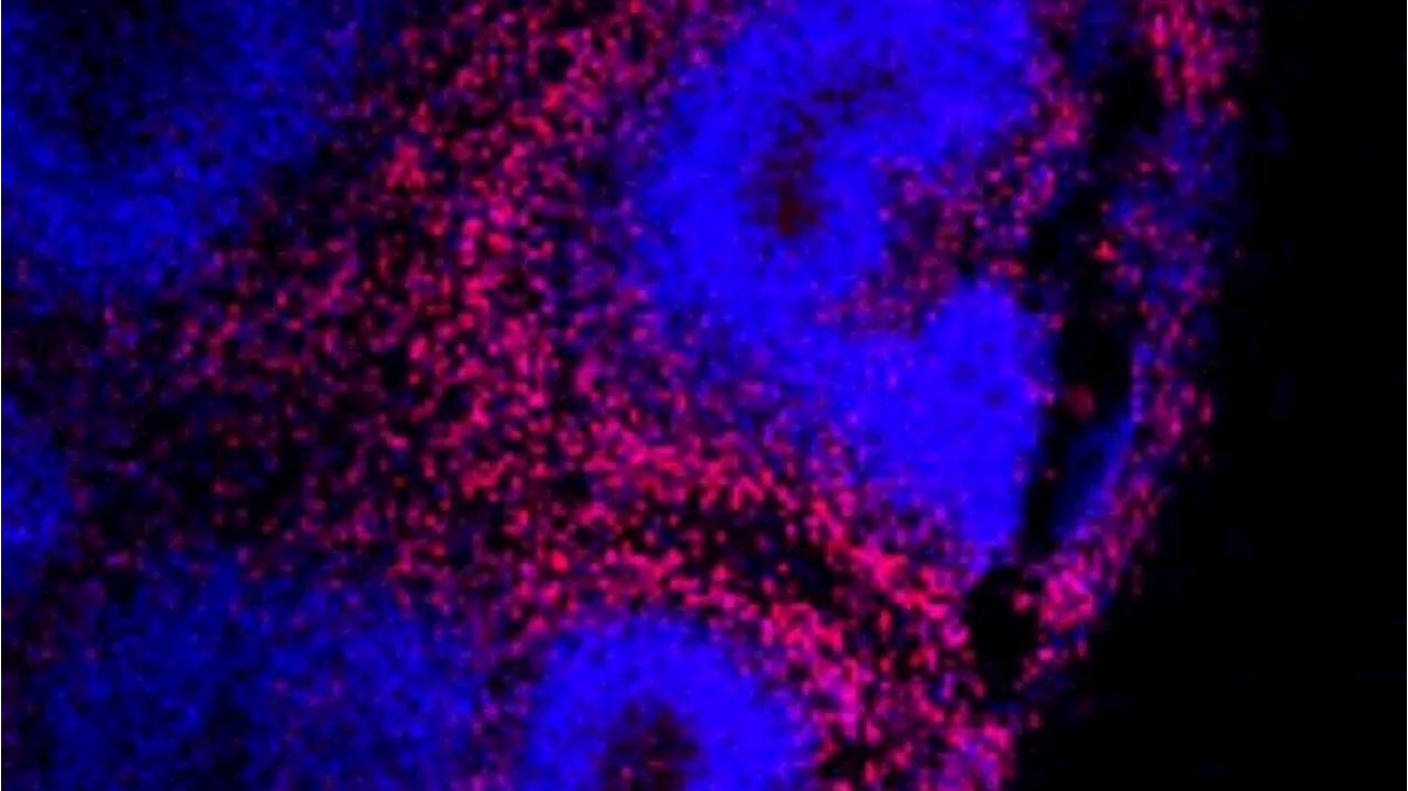 Dagli organoidi di cervello una nuova via contro l'Alzheimer
