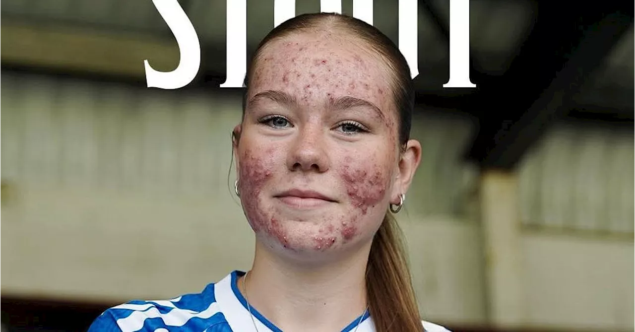16-åringen utsattes för näthat efter värvningen – klubben fick plocka ner inlägg