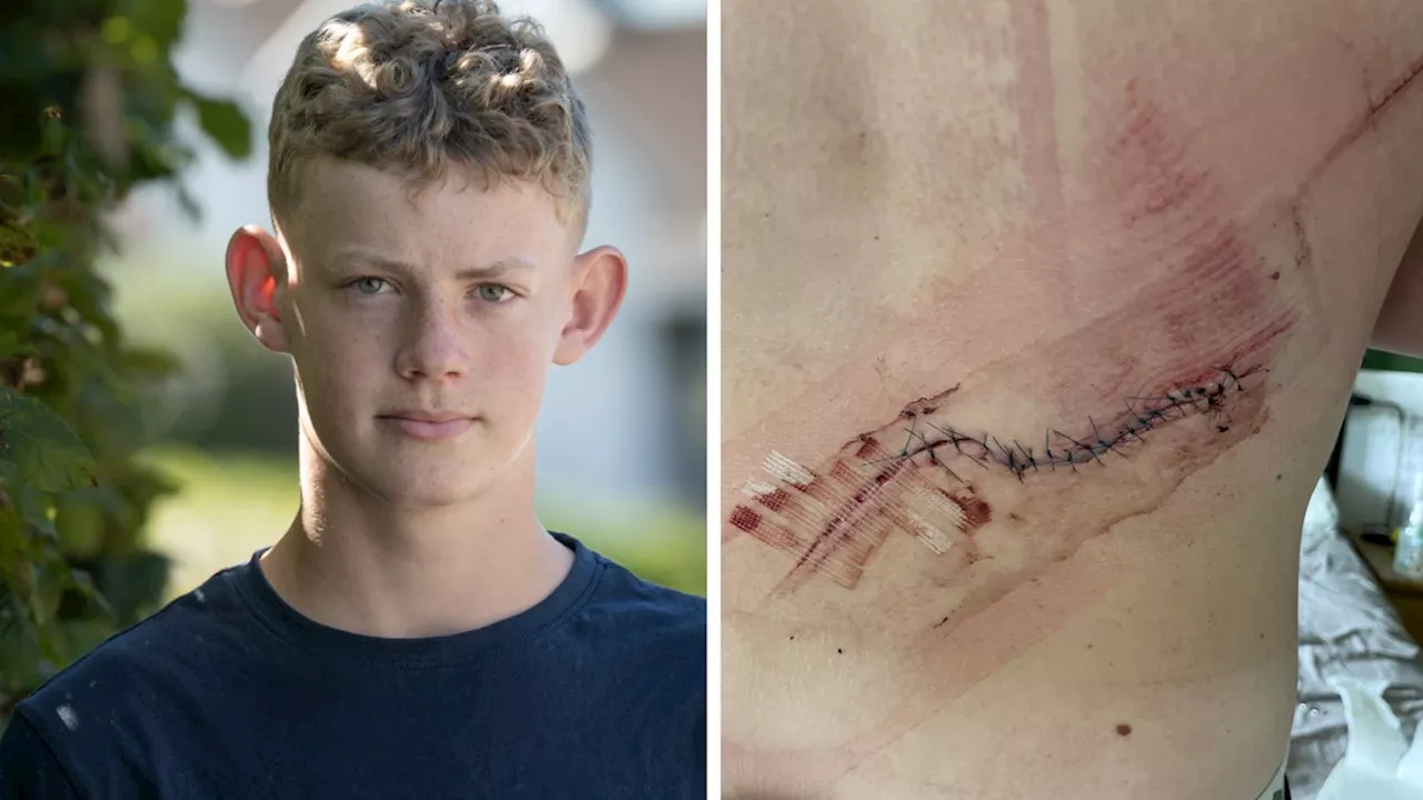 Max, 14, skar upp ryggen vid bad i Dalby stenbrott – efterlyser killarna som räddade honom