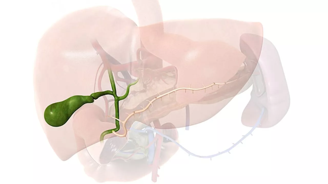 Primary Sclerosing Cholangitis Affects Outcomes in Paediatric IBD