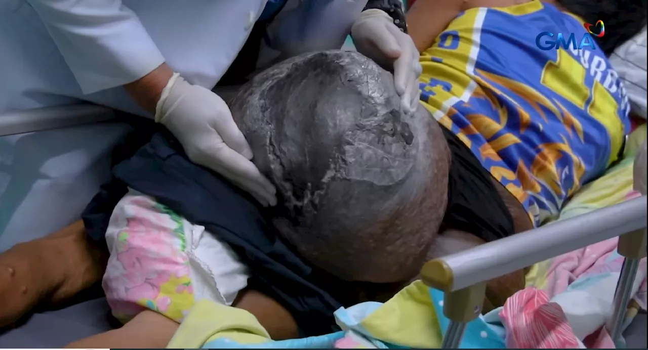 Lalaking lumobo ang puwet at nagkasugat, nais gumaling para maalagaan niya ang kaniyang ina