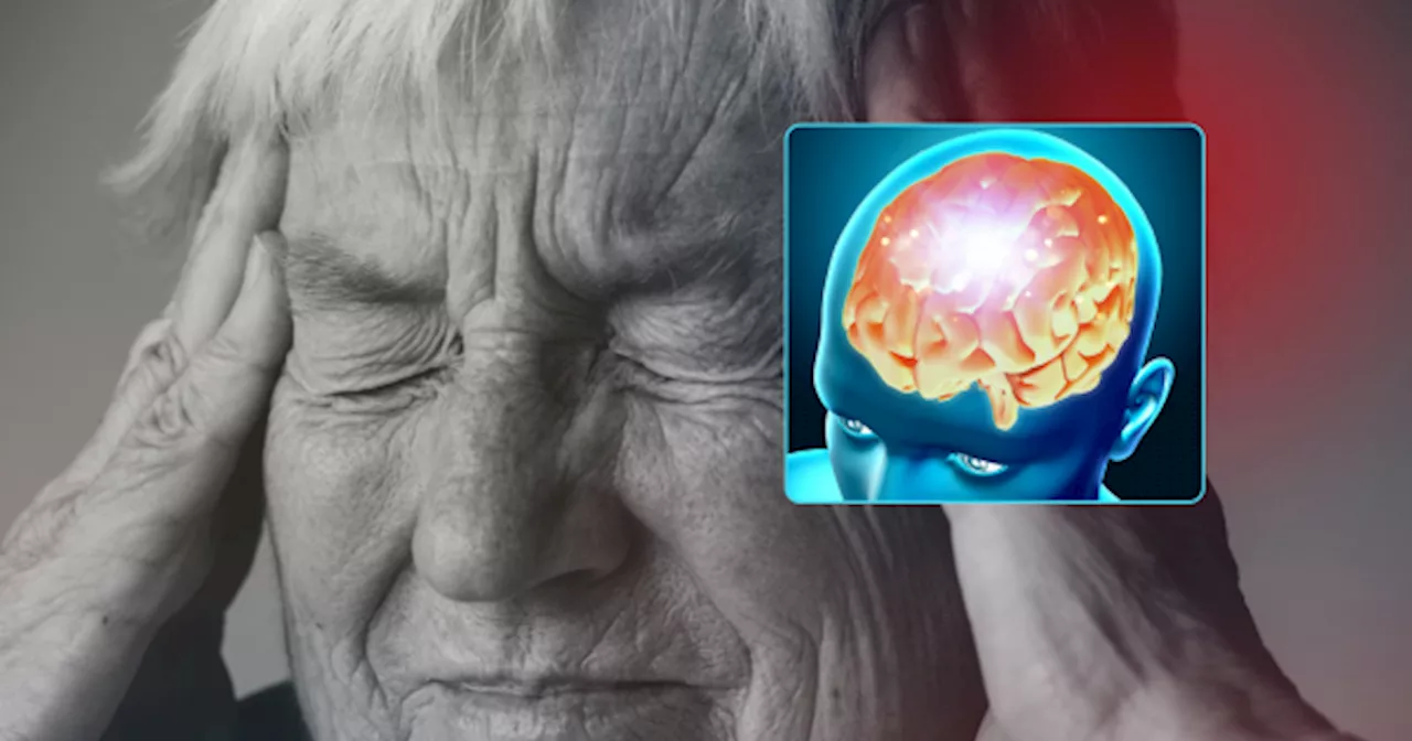 Derrame cerebral: el primer síntoma antes de sufrir un ACV que es crucial para salvar vidas