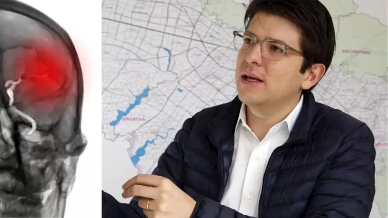 Miguel Uribe: ¿Qué es una hemorragia en el sistema nervioso central, episodio que lo tiene en condición crítica?